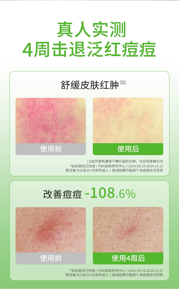 【双11抢购】Anua透明质酸精华液壬二酸舒缓泛红保湿提亮韩国护肤