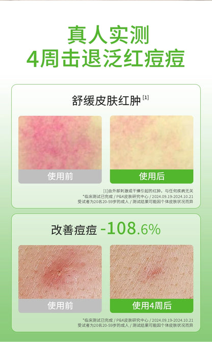 【双11抢购】Anua透明质酸精华液壬二酸舒缓泛红保湿提亮韩国护肤