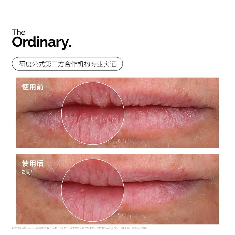 【新品】The Ordinary 5%PHA唇部精华15ml 保湿滋润去角质唇膏 by Beitbeauty.com